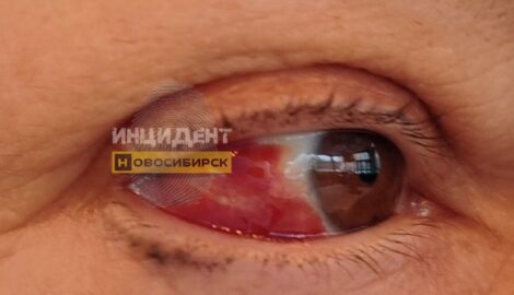 Опасная примерка: девушка серьезно пострадала в оптике из-за острого ценника